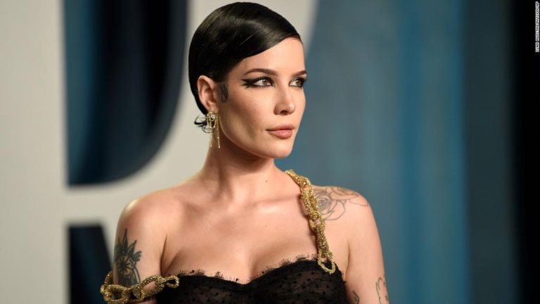 Halsey is ‘allergic to literally everything’ since giving birth and has been hospitalized multiple times