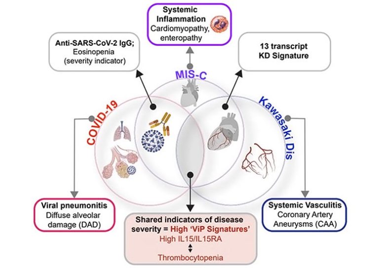 COVID-19, MIS-C and Kawasaki Disease Share Underlying Molecular Patterns and Immune Response