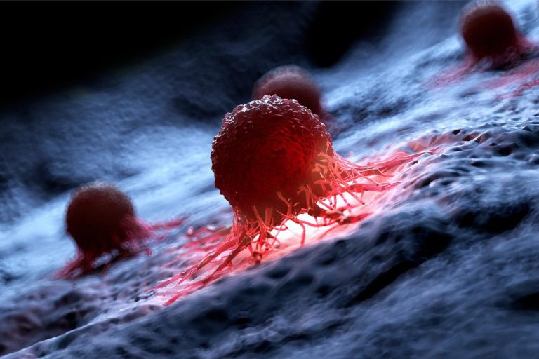 Yale Research Identifies Causes of Cancer