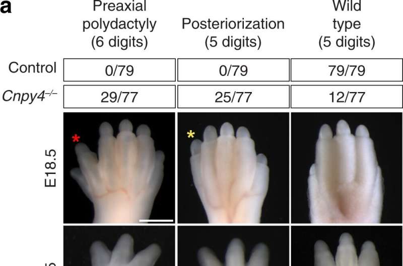 Scientists discover gene plays critical role in embryo development