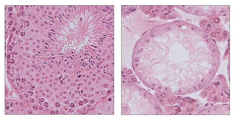 Shedding light on spermatogenesis failure caused by testicular warming