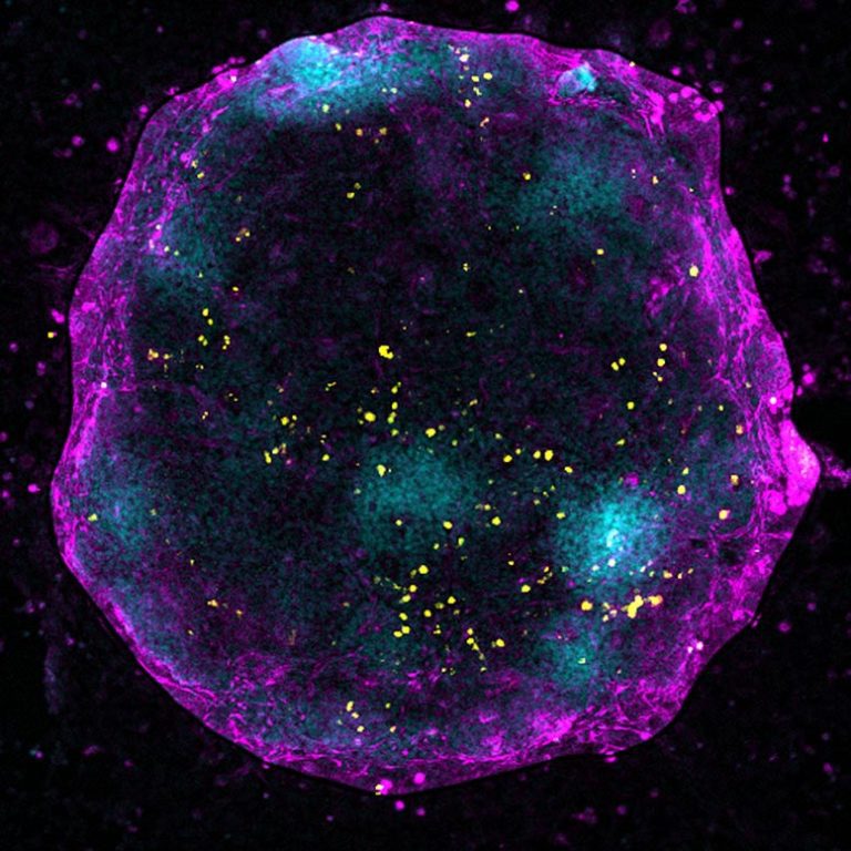 Turning X Chromosome “Off and On Again” Critical for Oocyte Development