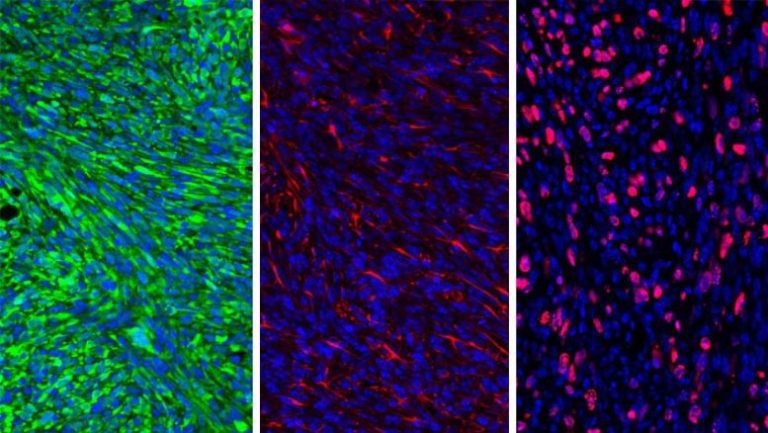 Using a Nanoparticle and Inhibitor To Trigger the Immune System