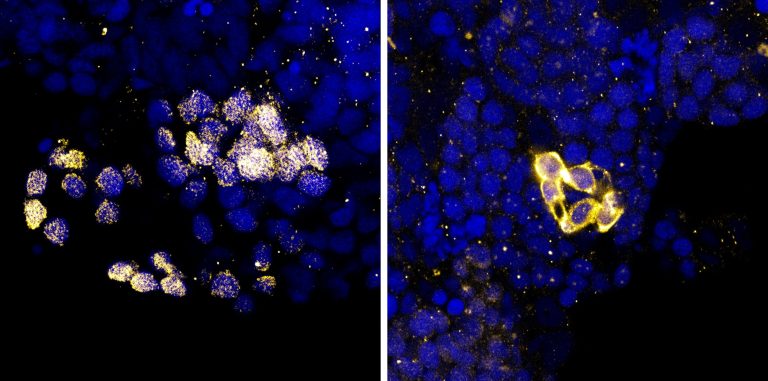 A new approach to Bloom syndrome research