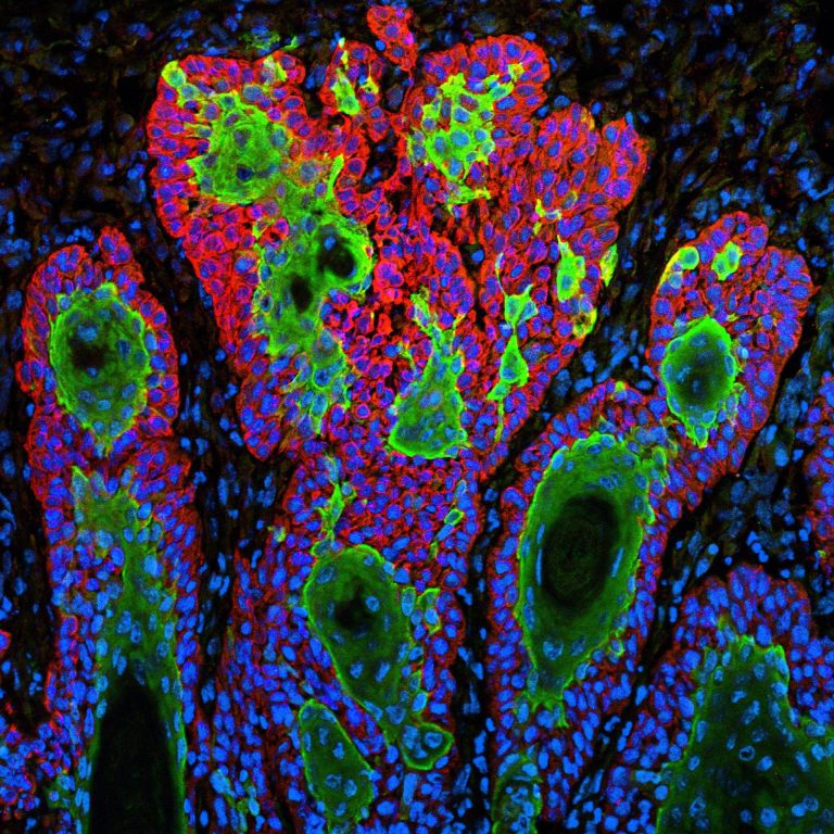 New method melds data to make a 3-D map of cells’ activities