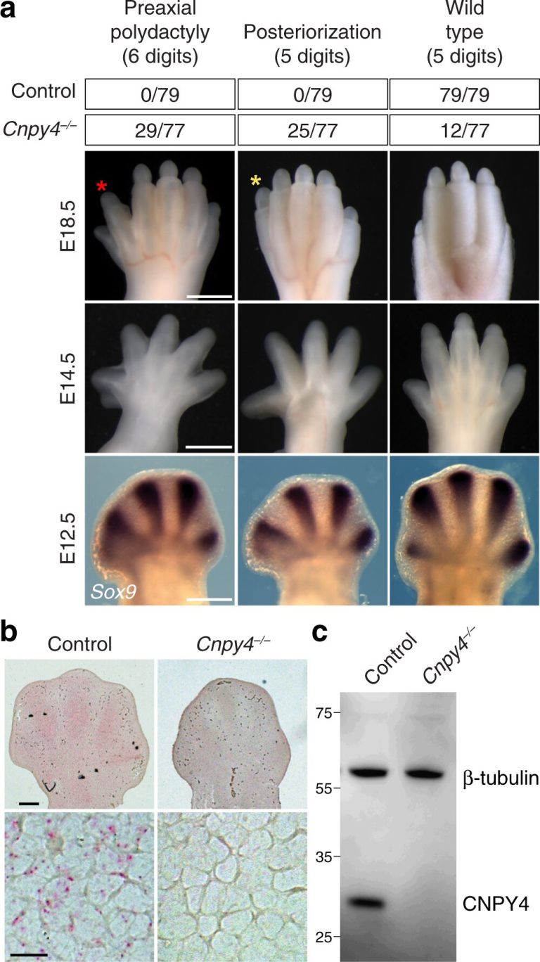 Scientists discover a gene that plays a critical role in embryo development