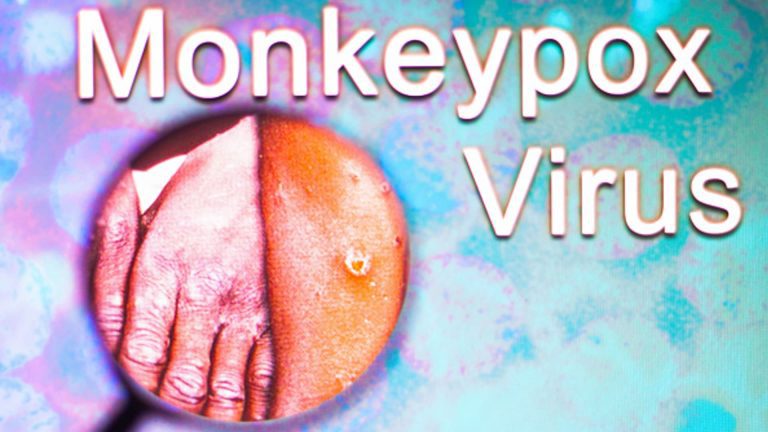 WHO says monkeypox has been spreading undetected as global cases rise to more than 550