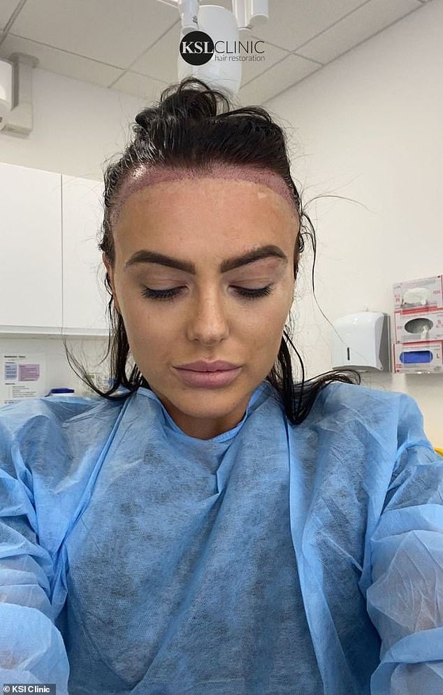 Results: Rosie decided to visit celebrity hair transplant surgeon and surgical director Dr Matee Rajput at his clinic in Manchester