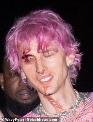 Worrying: Machine Gun Kelly left his own after party covered in blood and a cut above his eye alongside his fiancé Megan Fox on Tuesday night