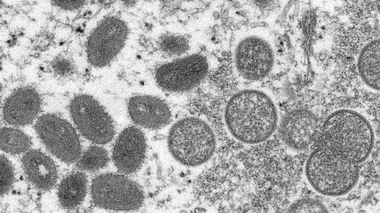 Airborne transmission of monkeypox ‘has not been reported,’ CDC says