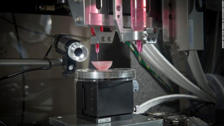 3D-printed organs: The future of transplantation