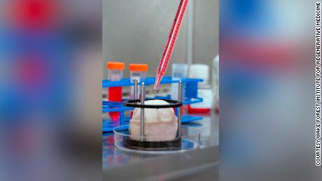 A bladder scaffold is seeded with cells at the Wake Forest Institute for Regenerative Medicine. 