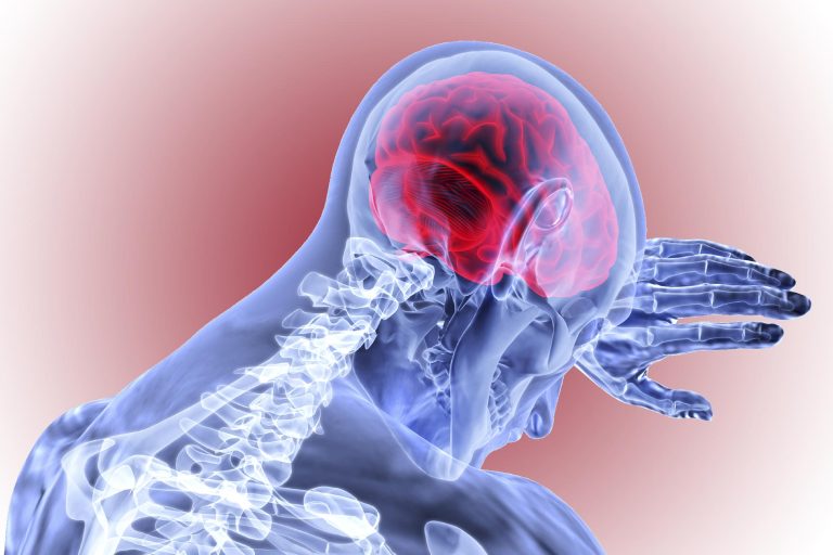 Want To Reduce Stroke Risk? Researchers Discover Simple Secret