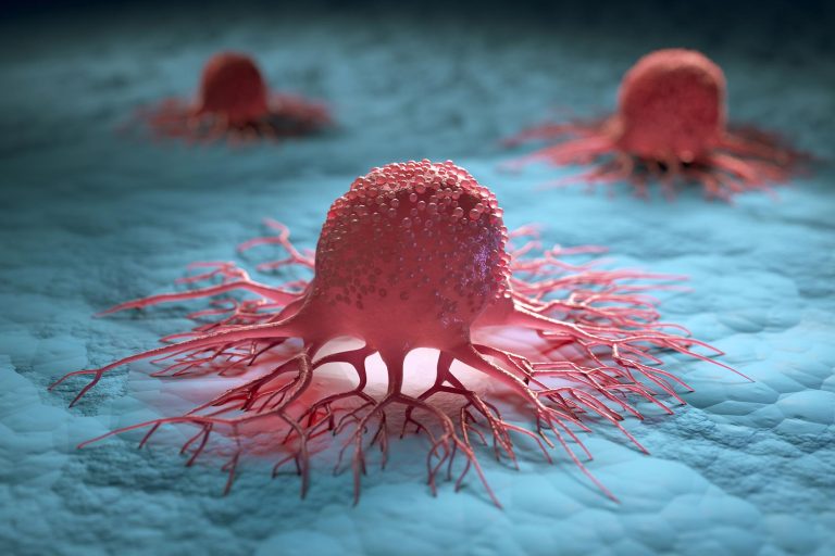 Scientists Discover an Alarming Rise in a Certain Cancer Variant