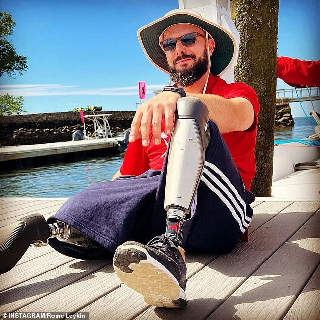 Epileptic tech worker, 36, shares how he lost both legs: Is now running marathon on prosthetics