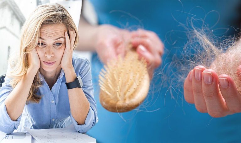 Hair loss: How stress could lead to ‘excessive’ shedding and how to combat this