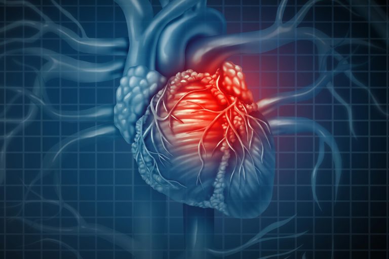 Johns Hopkins Researchers Have Developed a Method That Predicts Sudden Cardiac Death