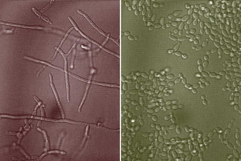 More Infectious Form of Yeast Candida albicans