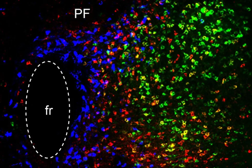 Parafascicular (PF) Thalamus