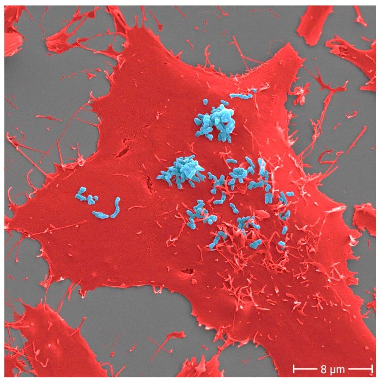 Basis for the development of a new class of antibiotics