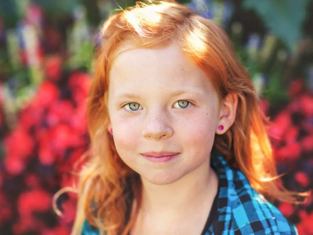 Image of little girl suffering from Waardenburg syndrome where she her hair color is orange. 