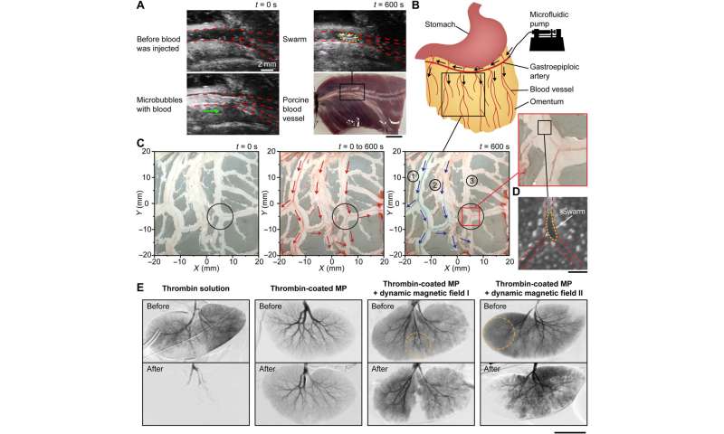 Microrobots in swarms for medical embolization