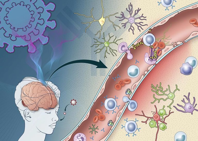 How Immune Response Triggered by COVID-19 May Damage the Brain