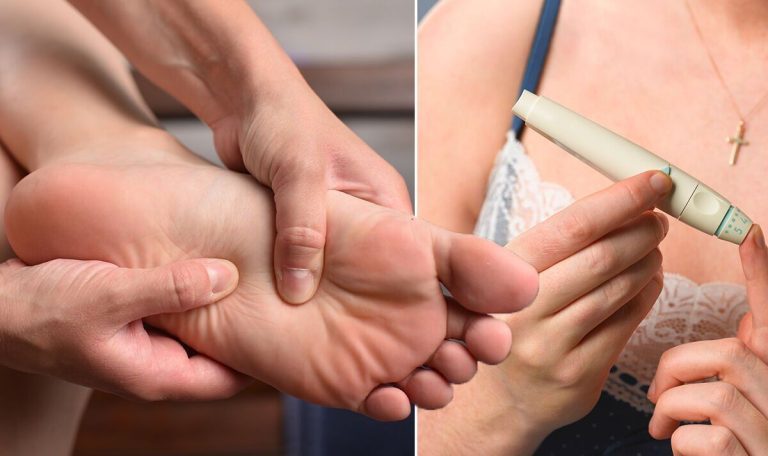 Diabetes type 2 symptoms: Two ‘hidden’ warning signs of high blood sugar in your feet