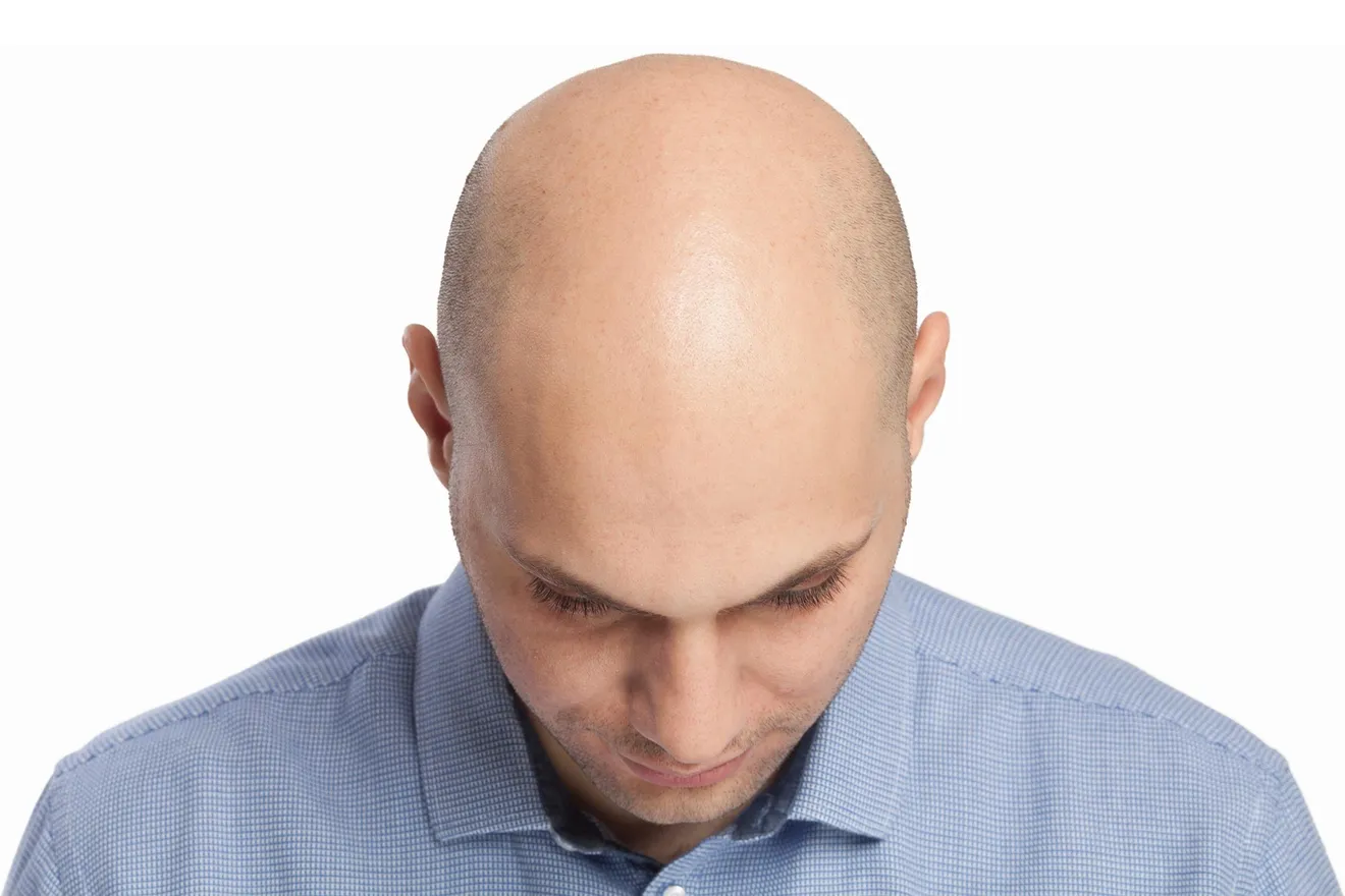 Bald Man Head