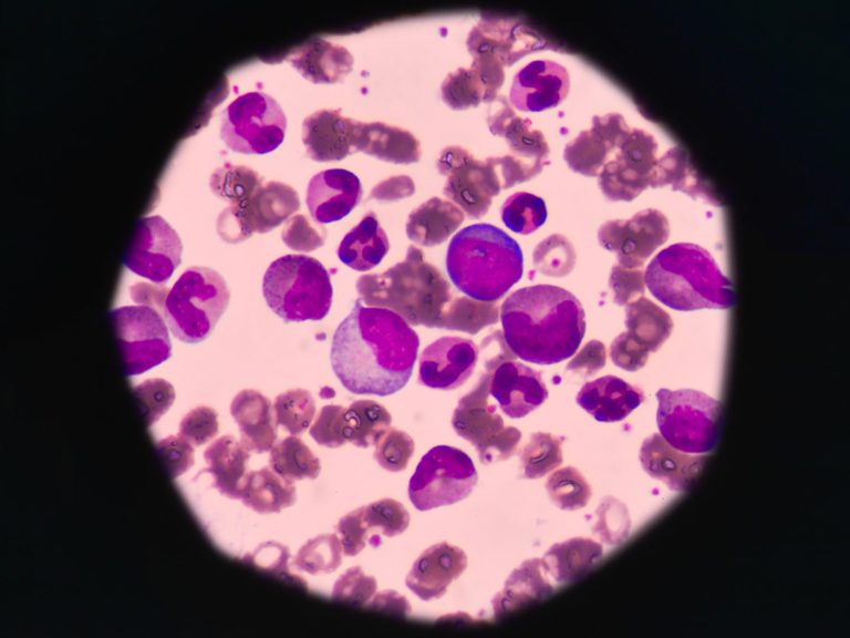 New Leukemia-Killing Compounds Discovered