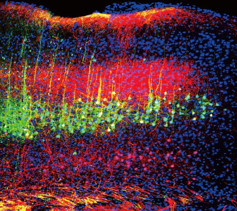 Newly Identified Brain Circuits May Point to Better Pain Therapies