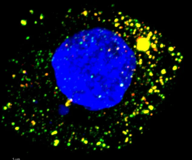 HAV-Infected Cultured Human Liver Cell