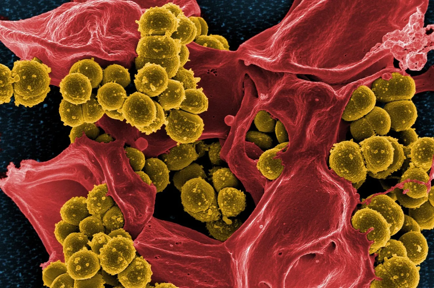 Staphylococcus aureus