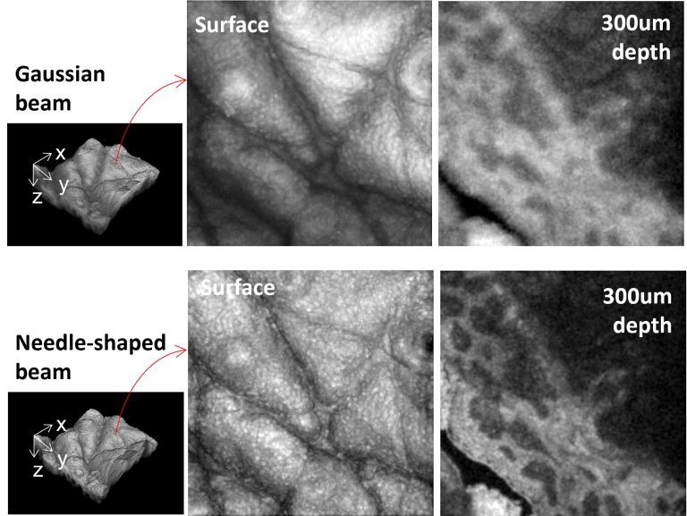 Flexible method for shaping laser beams extends depth-of-focus for OCT imaging