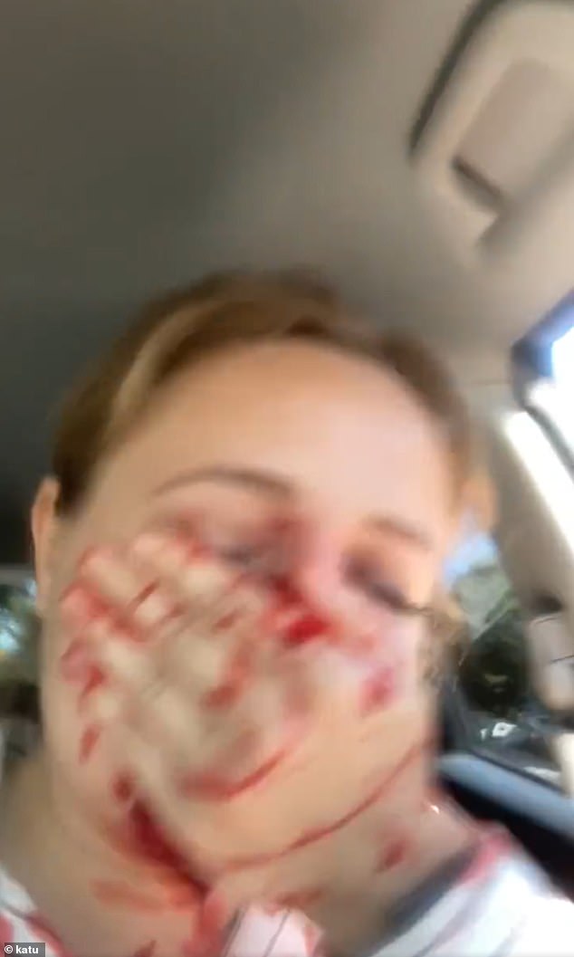 Katie holds her hand to her face in disbelief after being shot through her car window in Portland