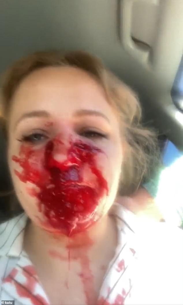 It's believed that Katie's face was pierced by the bullet during a gang-related confrontation by two people standing on opposite sides of the street