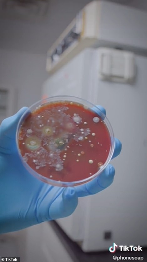 Three days after incubating the dish he found it exploded with bacteria