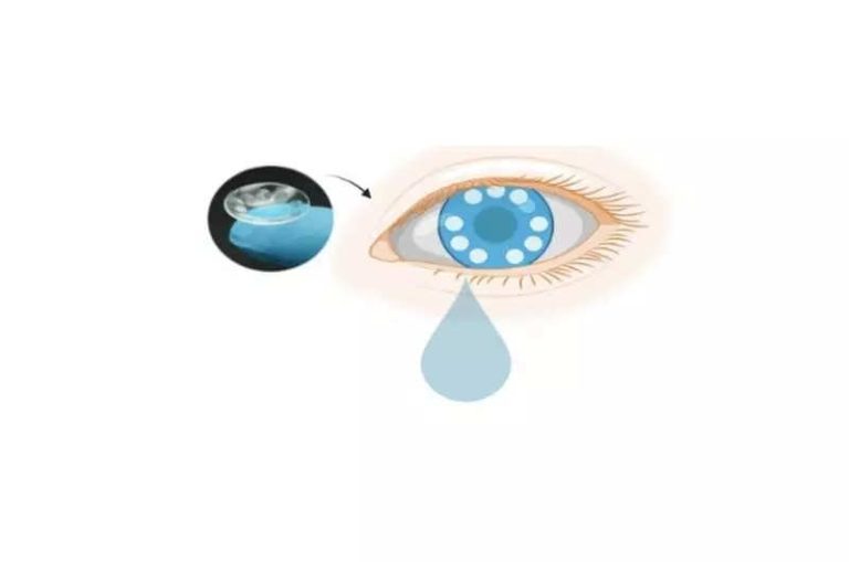 This smart contact lenses can diagnose cancer from tears