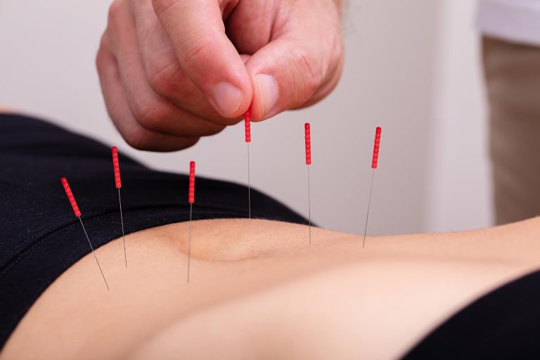 New Research Finds That Acupuncture May Help Ward Off Diabetes