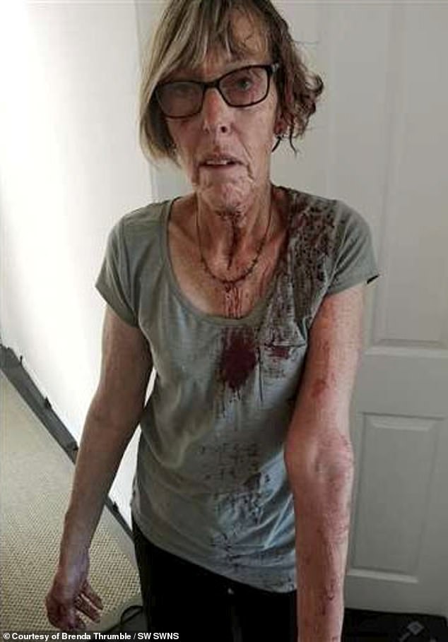 Grandmother, 66, is left bloodied after crazed seagull attack 