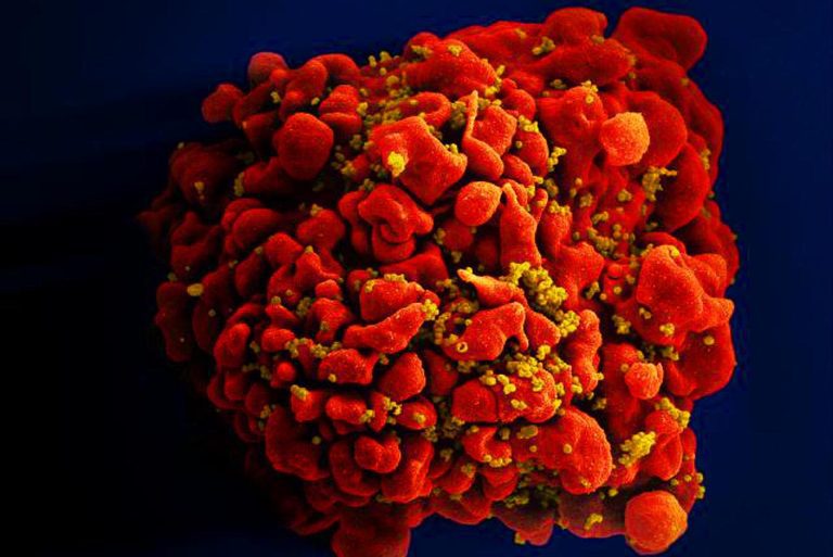 HIV Accelerates Aging by 5 Years