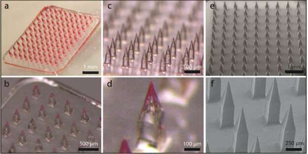 Microneedles unlock curcumin’s therapeutic potential 