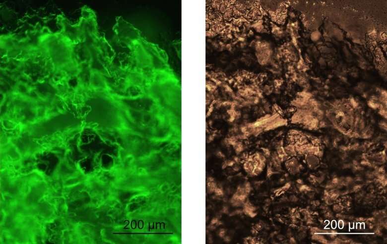 Scientists develop gel made from spider silk proteins for biomedical applications