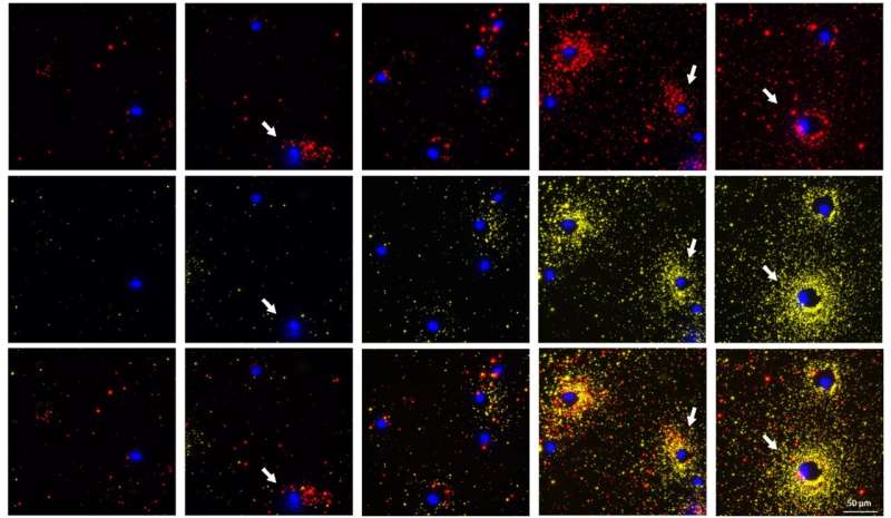 'Simple yet powerful': Seeing cell secretion like never before