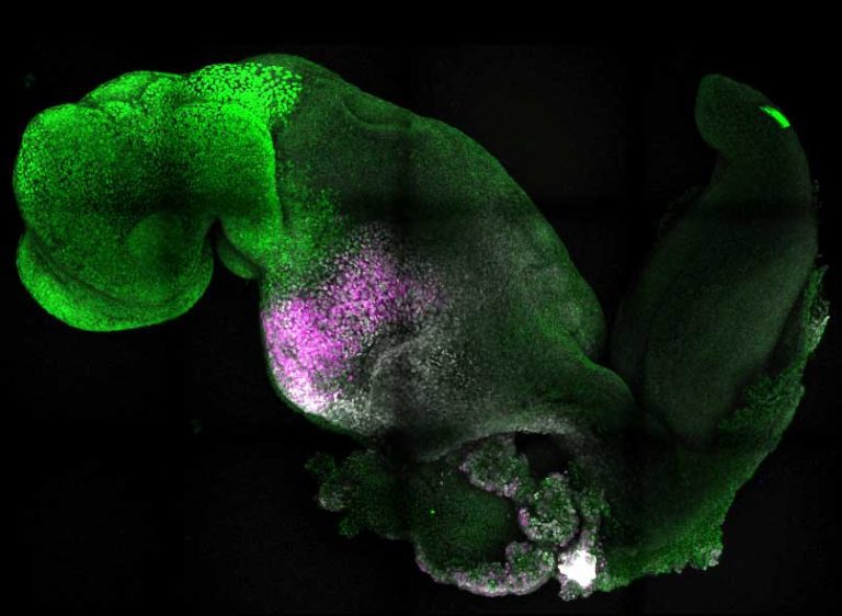 Scientists Grow “Synthetic” Embryo With Brain and Beating Heart – Without Eggs or Sperm