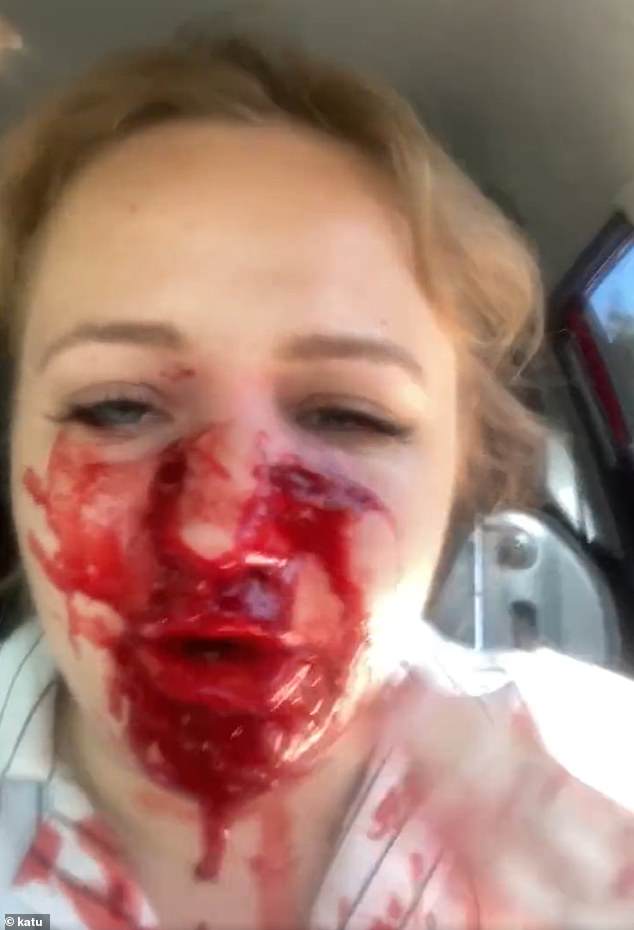 Ukrainian woman in crime-ridden Portland shares bloody video of bullet-shattered face