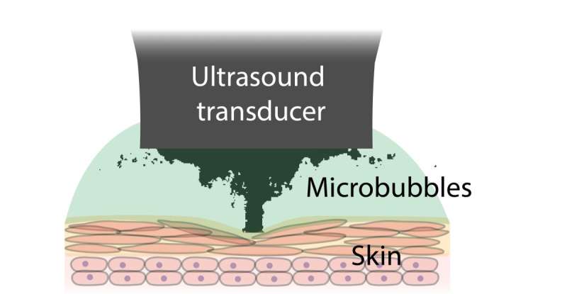 Using sound and bubbles to make bandages stickier and longer lasting