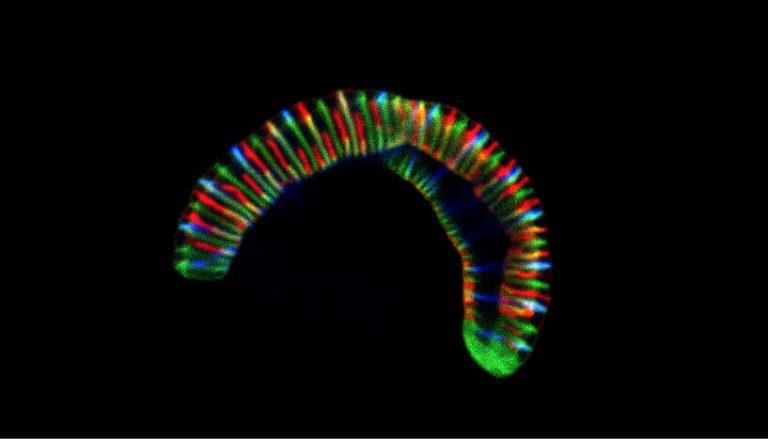 Research team investigates the caterpillar-like bacteria crawling in our mouths