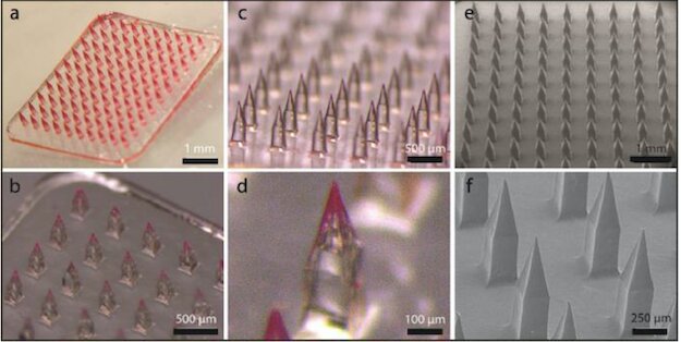 Microneedles unlock curcumin’s therapeutic potential