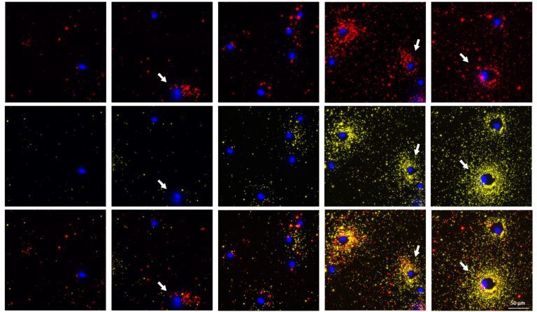 Seeing cell secretion like never before